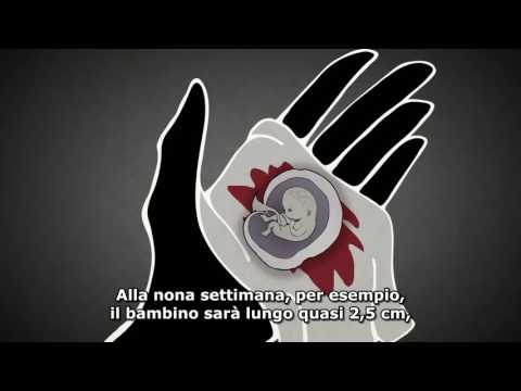 Dolori muscolari da parassiti Pulizia di medicine di parassiti
