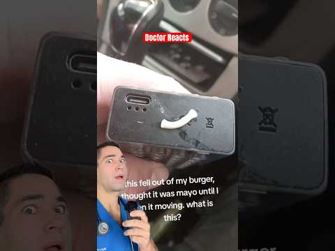 Doctor Reacts: tapeworm burger?!