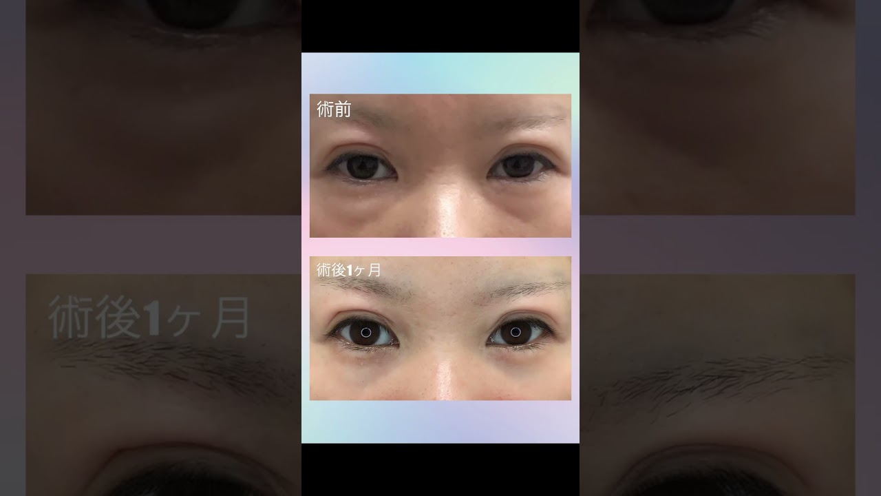Youtubeのサムネイル