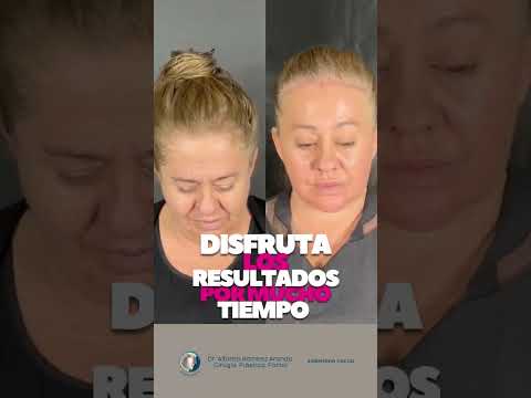 Alfonso Ramírez Aranda-49