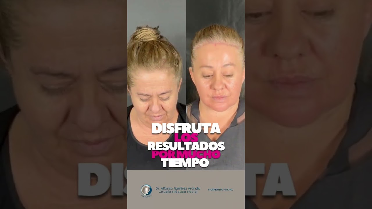 Alfonso Ramírez Aranda-46