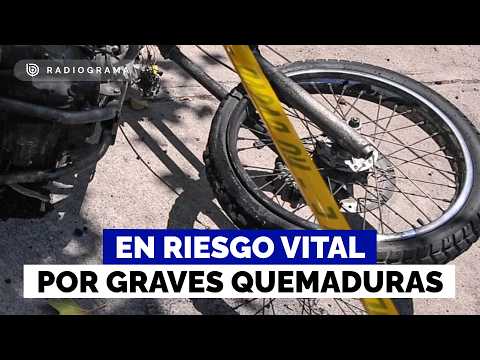 Menor de 14 años en riesgo vital por graves quemaduras tras explosión de su motocicleta