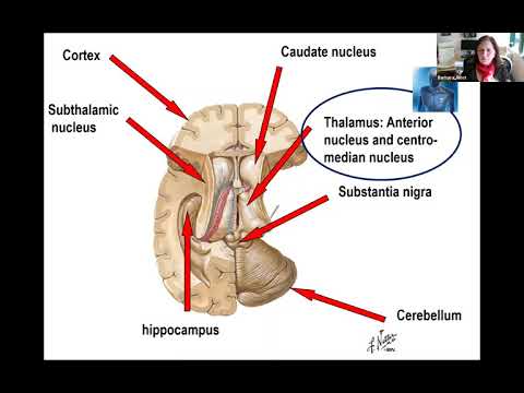 AES Professor's Rounds: Neurostimulation Case Studies