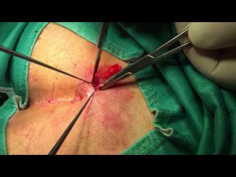 RMN del rachide cervicale nel prezzo Belgorod Recensione tutore sulla caviglia