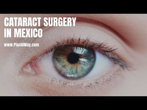 Cataract Surgery in Mexico