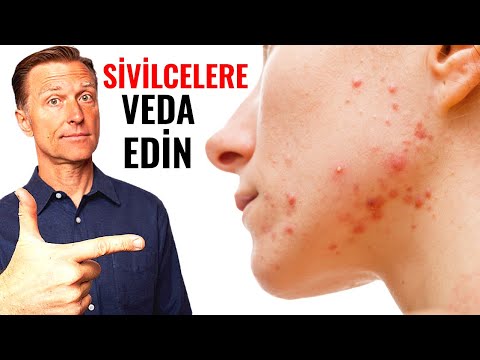 Lazerle Sivilce (Akne) Tedavisi - Dermatolog Dr. Aslı Eralp