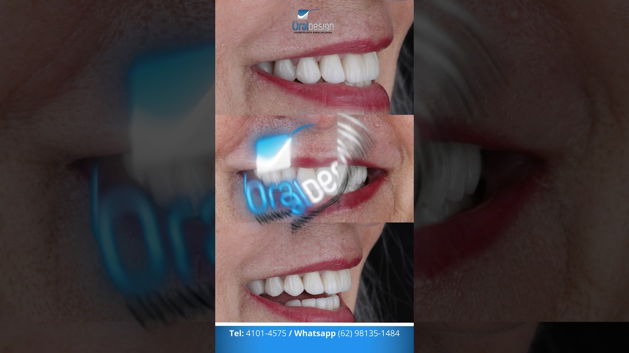 Danilo Monteiro Rezende Pereira-32