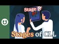 What Are The Stages Of CLL CLL