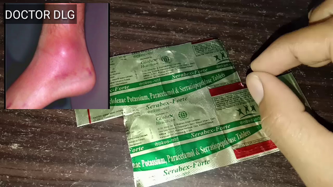 Swelling tablet, सूजन के लिए टैबलेट,Serabex forte tablet Use l swelling tablet l swelling treatment,
