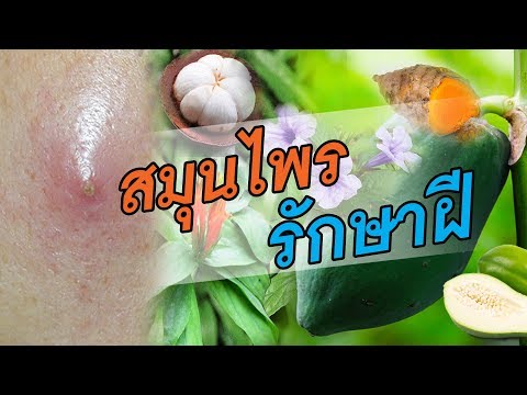 ยาสำหรับโรคสะเก็ดเงินบนเส้นผมที่ศีรษะ น้ำมันยี่หร่าดำช่วยกลาก