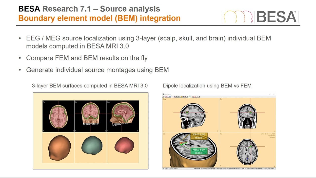 BESA Research 7.1