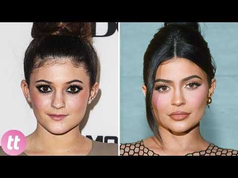 The Kardashians Before Plastic Surgery