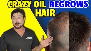 Botanical Oil Now PROVEN To Regrow Hair