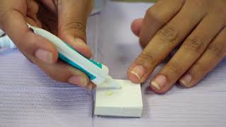 Download lagu Dental Assisting 101: What dental assistants need to know about mixing Dycal mp3 Download lagu Dental Assisting 101: What dental assistants need to know about mixing Dycal mp3