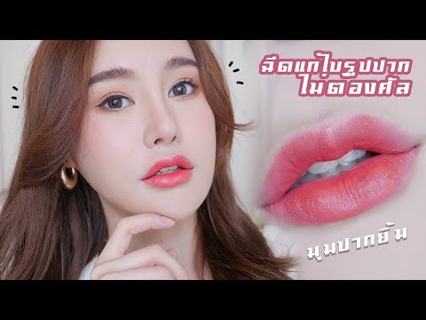 ฉีด ฟิลเลอร์ ปาก