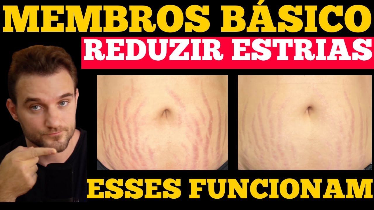 Dermatologist explains stretch marks: treatments that work (and those that just cost money)