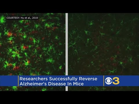 Scientists Say They Have Successfully Reversed Alzheimer’s Disease In Mice