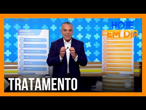 Você e o Doutor: como diagnosticar e tratar artrite e artrose?