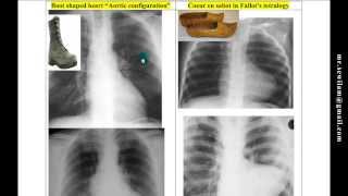 Dr.Mahmoud Sewilam, Heart X-Rays