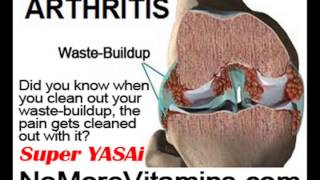 Arthrosis Vs Osteoarthritis by NoMoreVitamins com