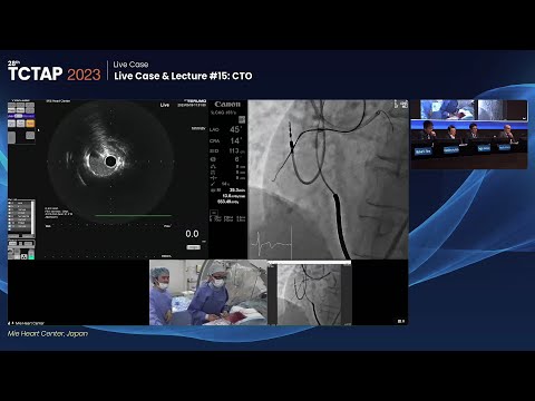 [TCTAP 2023] Live Case & Lecture #15: CTO