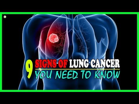 9 Signs Of Lung Cancer That Most People Ignore - Lung Cancer Symptoms | Best Home Remedies Video