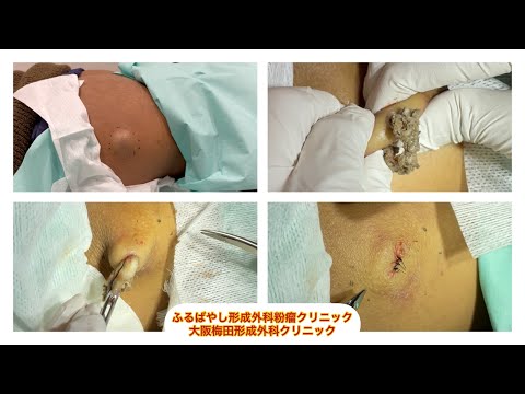 形成外科について詳しく解説