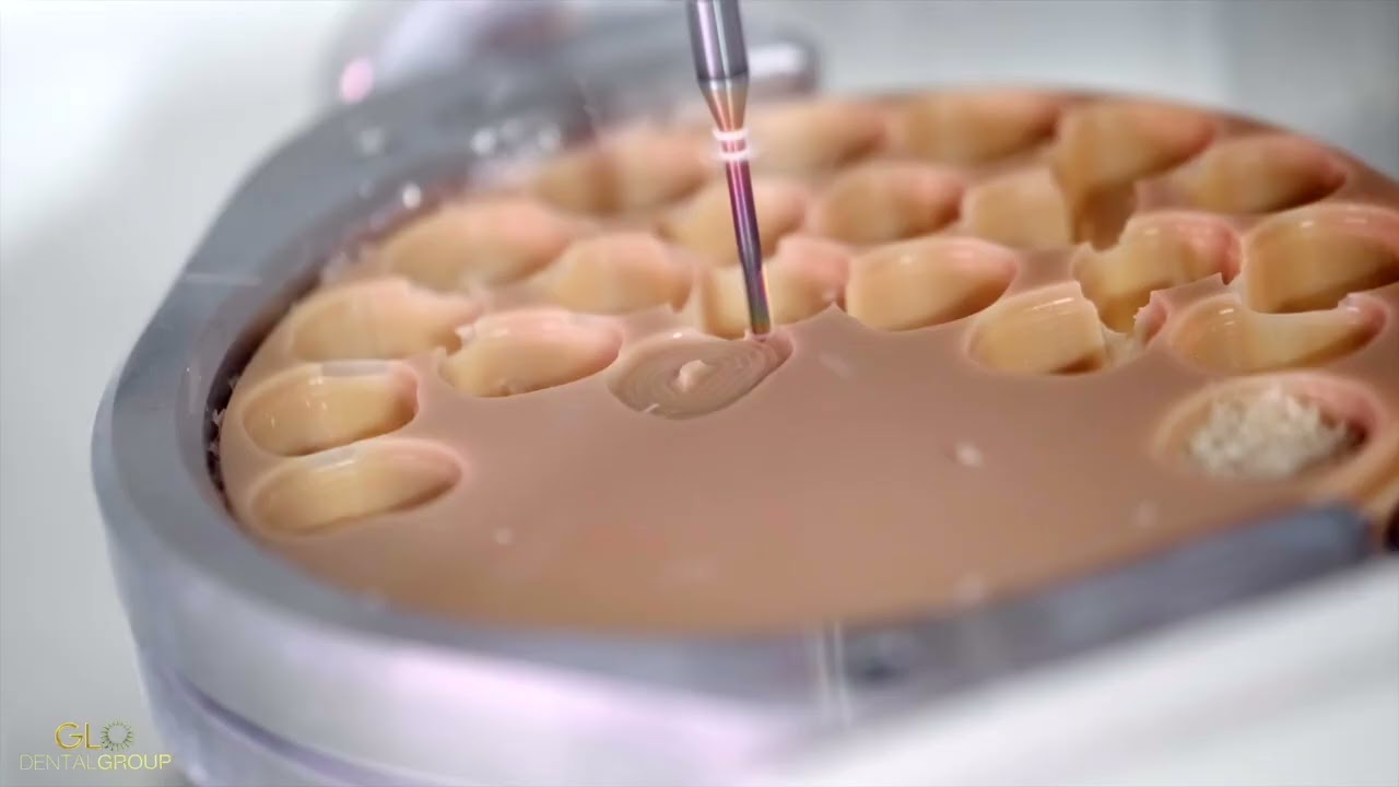 Behind the Scenes: Crafting Smiles at the Dental Lab | Veneers, Implants & More