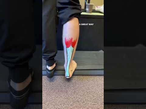 How to strengthen the Achilles tendon