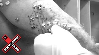 Chris Jericho gets tacks removed from his body after Extreme Rules: May 23, 2016