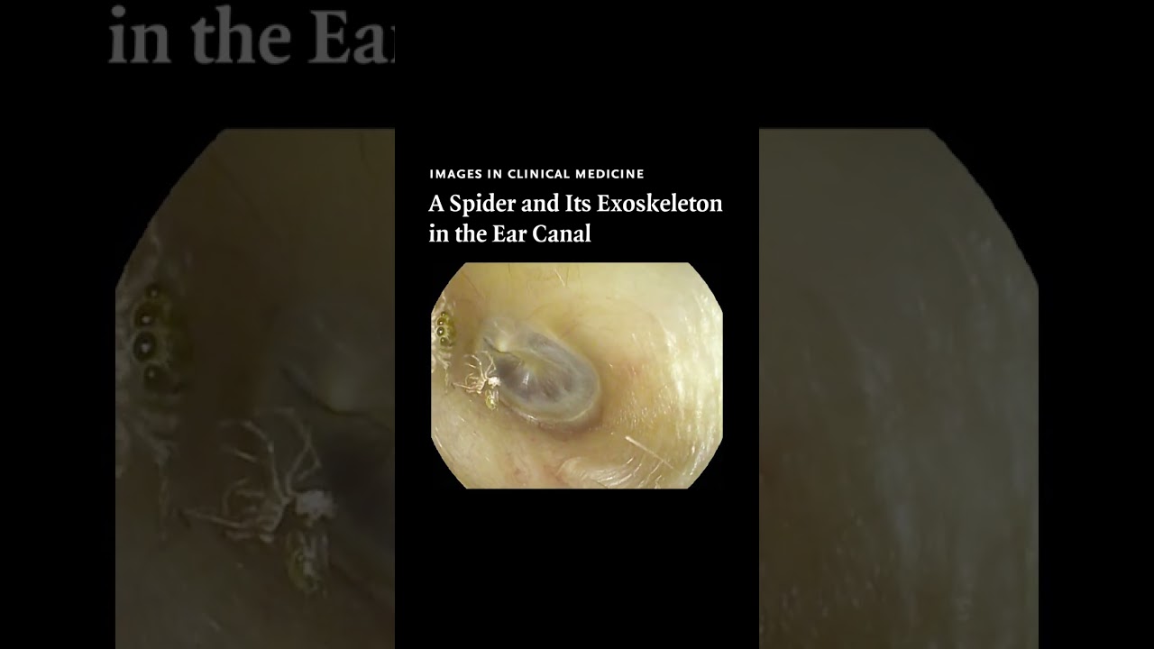 youtube video id=3nI-wUeUwRA