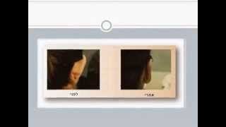 הצמדת אוזניים - ד"ר וינברגר (מנתח פלסטי) מסביר את כל מה שצריך לדעת על טיפול הצמדת אוזניים