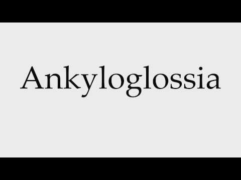 How to Pronounce Ankyloglossia