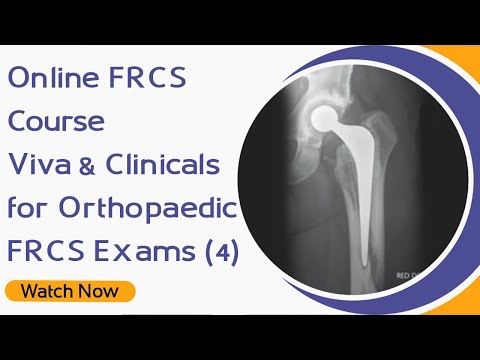 Cours FRCS en ligne - Viva et Cliniques pour l'Examen Orthopédique FRCS (4)