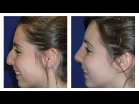 Desire Physical Transformation? Plastic Surgery May Be The Thing For You