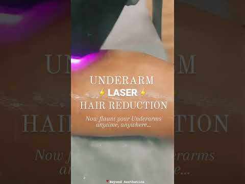 Laser Hair Reduction | Beyond Aesthetics by ns3