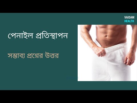 পেনাইল প্রতিস্থাপন - প্রায়শই জিজ্ঞাসিত প্রশ্ন