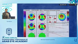 Abnormal Pentacam scenarios Lecture