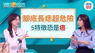 長痣會癌變?這類形狀要注意!