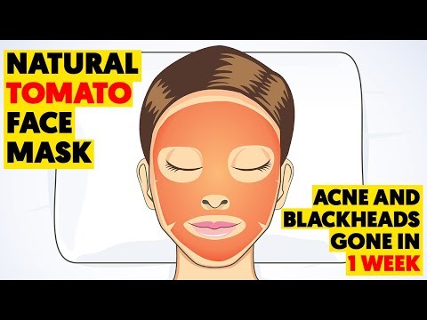 download lagu mp3 mp4 Lemon And Honey For Blackheads Review, download lagu Lemon And Honey For Blackheads Review gratis, unduh video klip Lemon And Honey For Blackheads Review