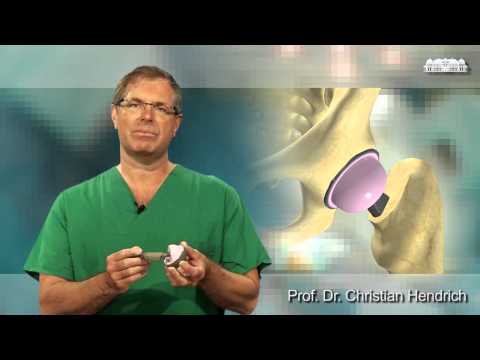 Artificial hip - minimally invasive surgery (short version) by Prof. Christian Hendrich