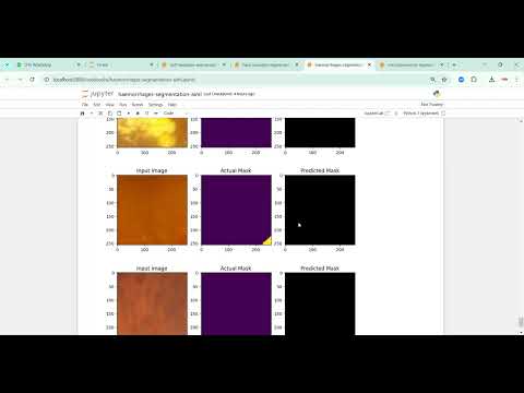 Diabetic Retinopathy Resnet50 Resnet101 VGG19 InceptionV3 Xception NASNetLarge VGG16 MobileNet DenseNet-201 in Python Projects