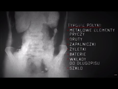 download lagu mp3 mp4 Zakad Metalowy, download lagu Zakad Metalowy gratis, unduh video klip Zakad Metalowy