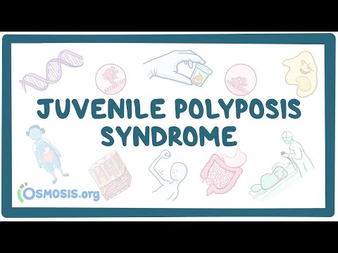 Rheumatic fever heart disease an Osmosis Preview