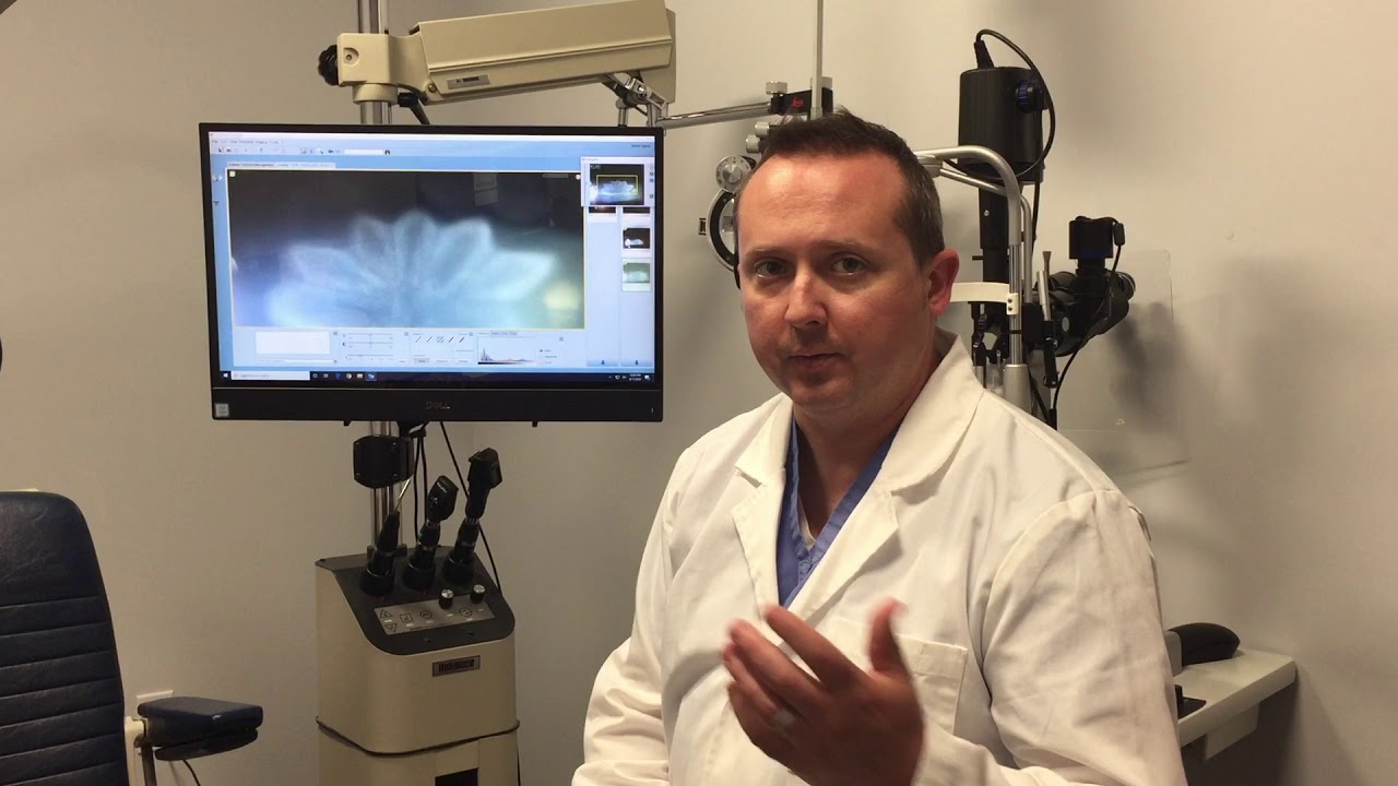 Dr. Josh Discusses Cataracts
