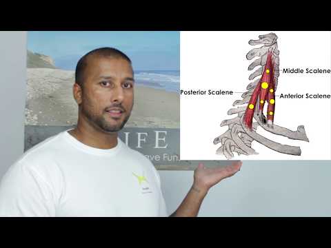 Painful Turning Neck - Release Scalene Trigger Points