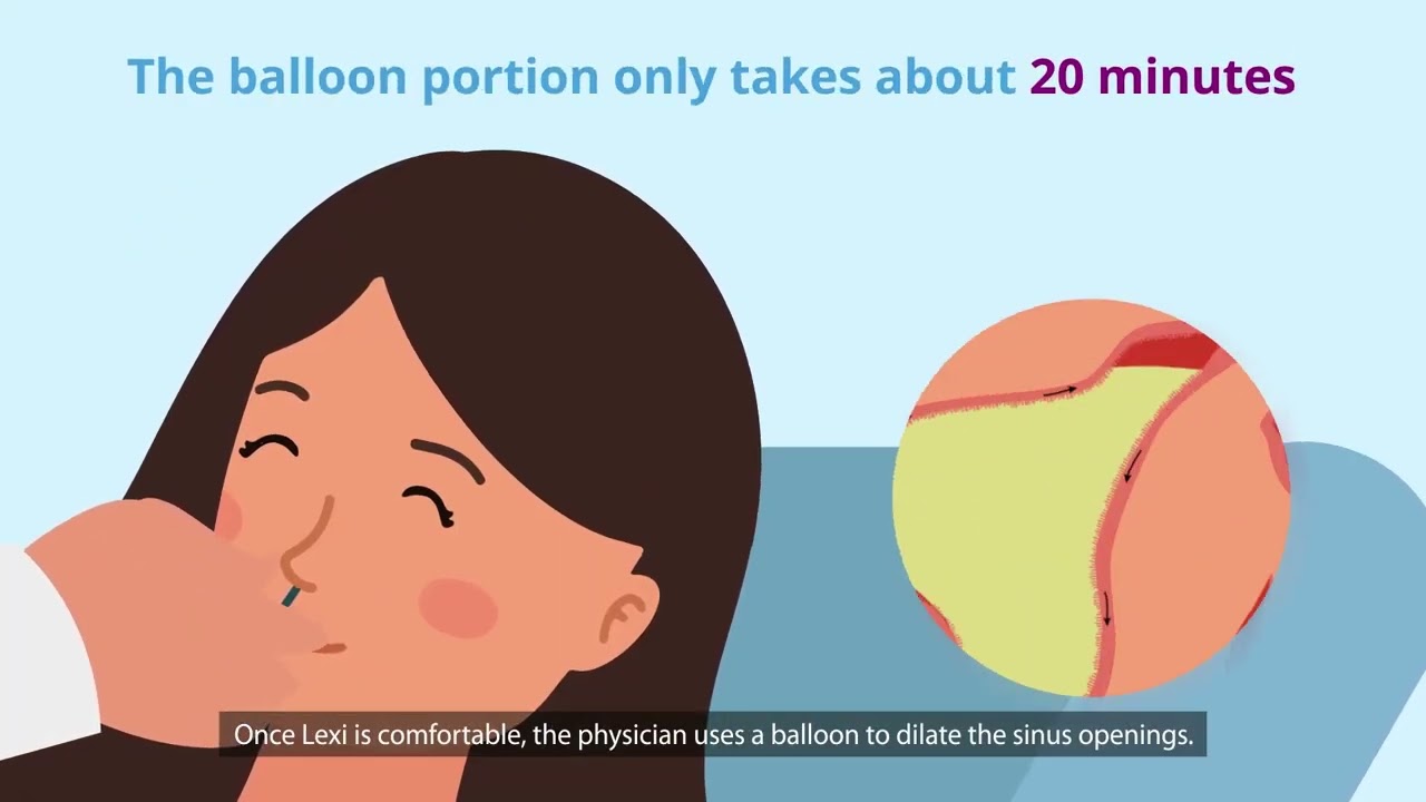Day in the life of a balloon sinus dilation patient