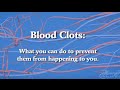 Blood Clot Prevention What You Need To Know About Deep Vein Thrombosis And Pulmonary Embolism