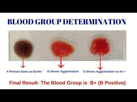 Blood Group Test- Different Types of Blood Group