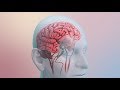 What Causes A Stroke